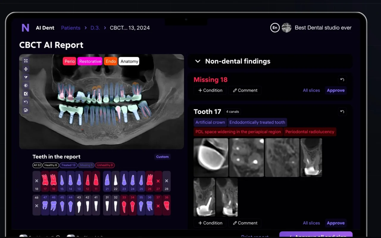 Diagnocat (AI Dent): CBCT AI report screen