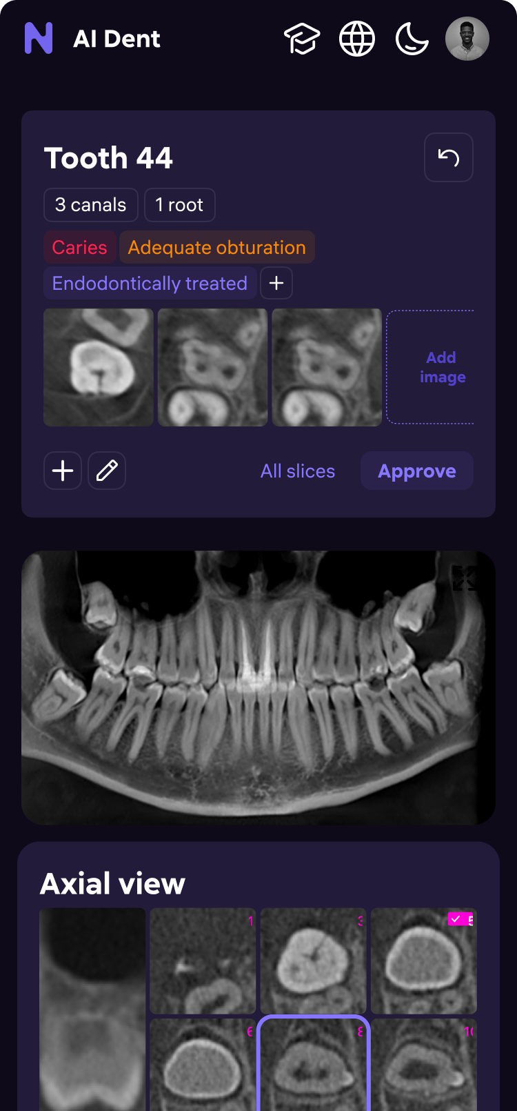 AI Dent — screen 10