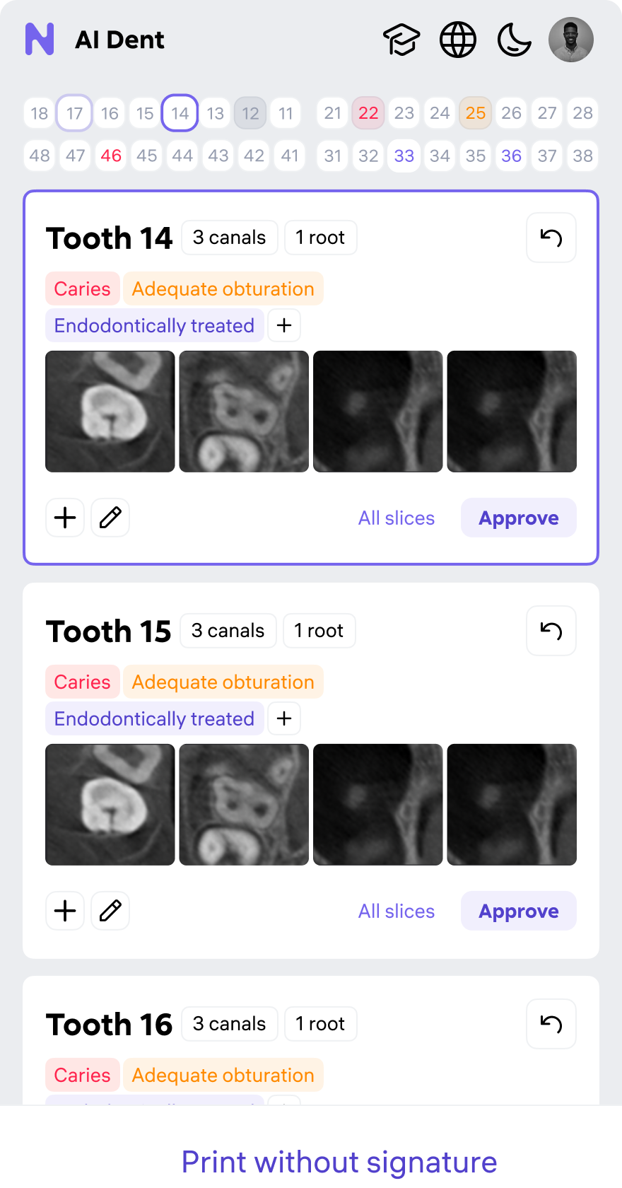 AI Dent — clinical screen 1