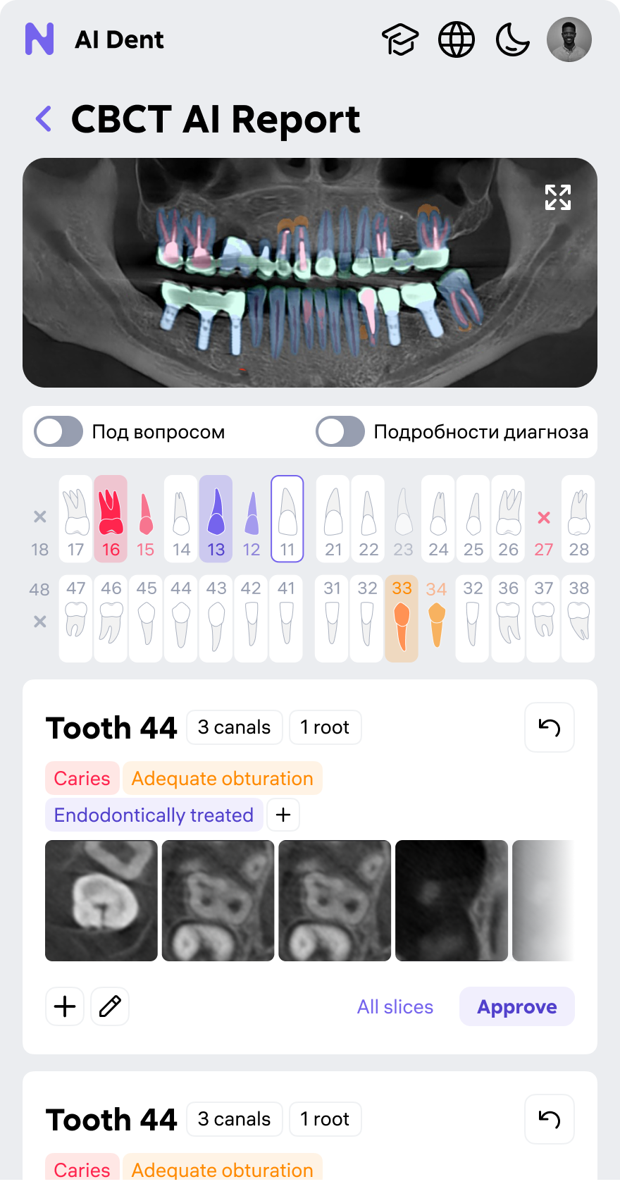 AI Dent — clinical screen 2