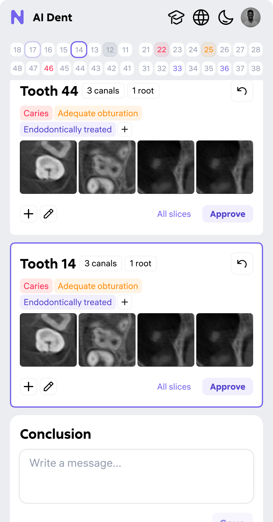 AI Dent — clinical screen 3