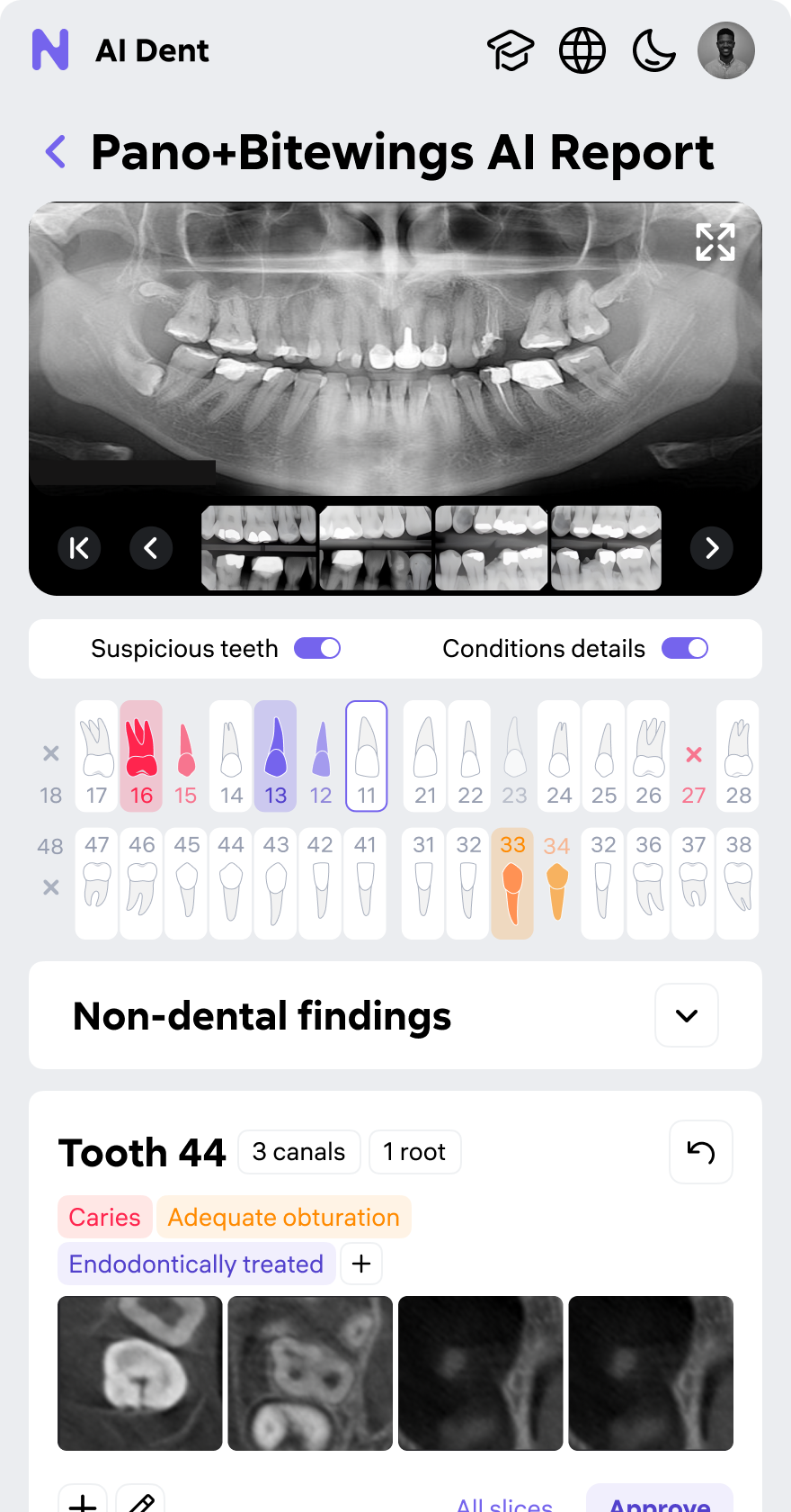 AI Dent — clinical screen 4