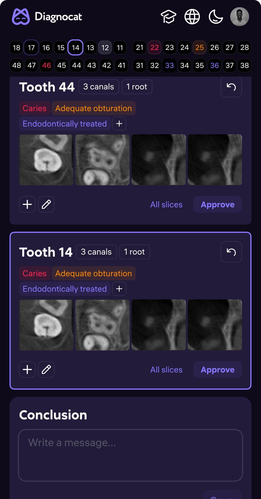 AI Dent — clinical screen 5