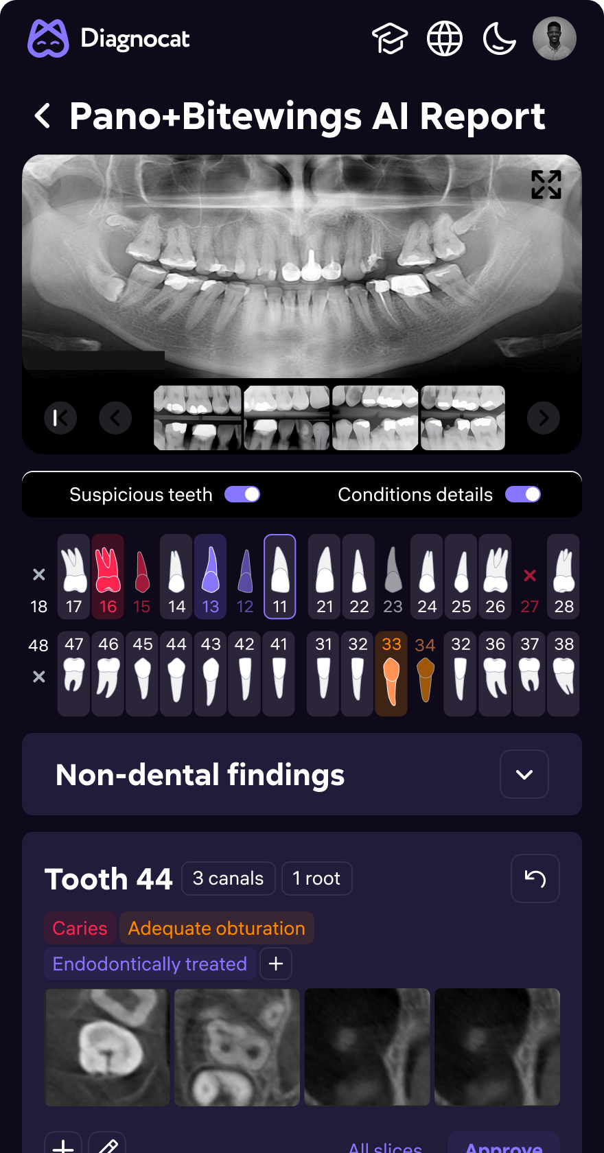 AI Dent — clinical screen 6