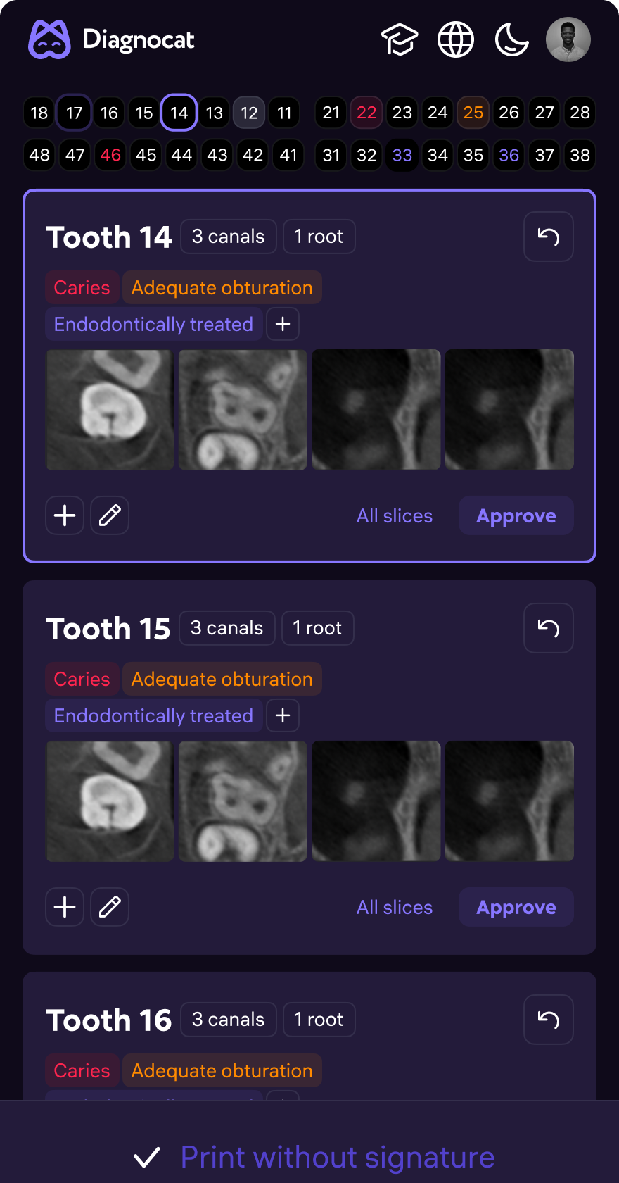 AI Dent — clinical screen 7