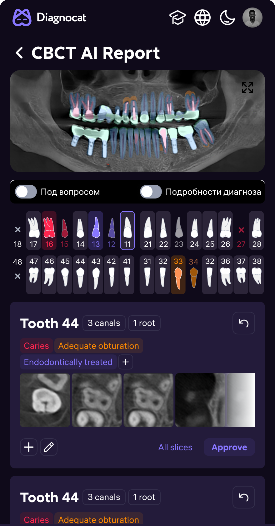 AI Dent — clinical screen 8