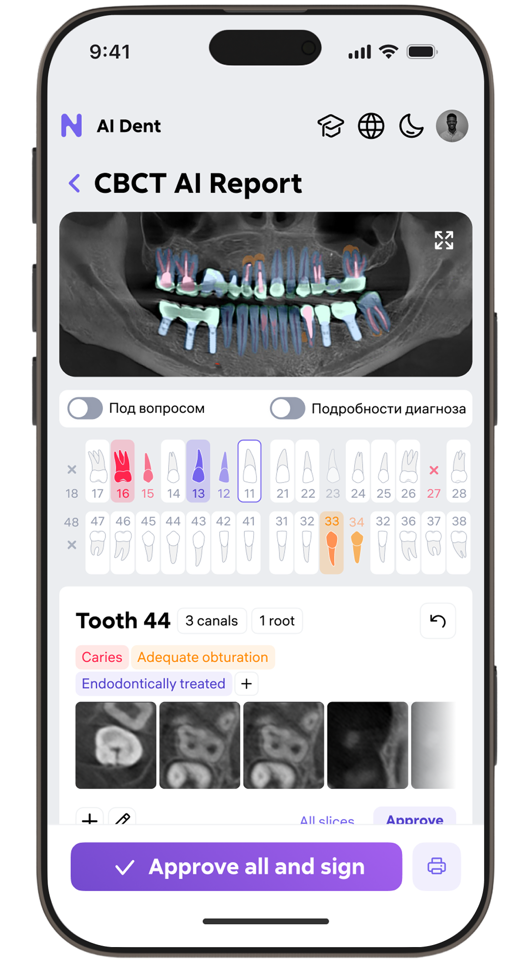 AI Dent mobile — patient list dark