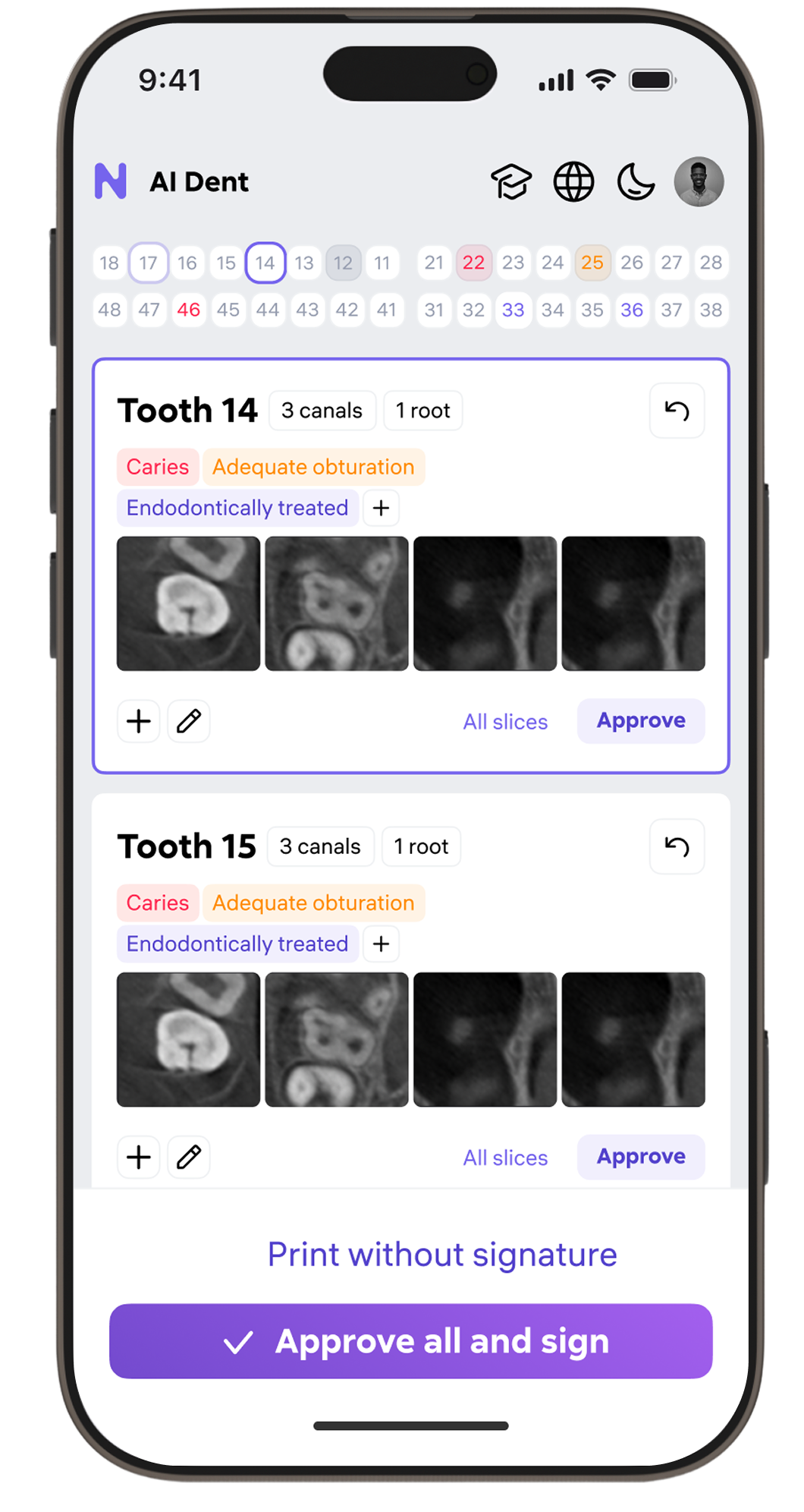 AI Dent mobile — tooth detail dark