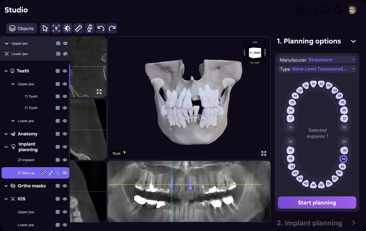 AI Dent Studio — Treatment Planning AI, 02/04
